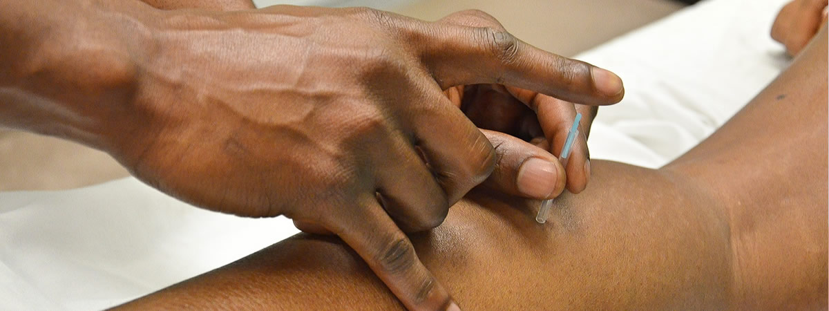 Acupuncture Treatments